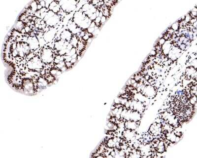 Immunohistochemistry-Paraffin: PTBP1 Antibody (JU41-20) [NBP2-75634] - Analysis of paraffin-embedded mouse large intestine tissue with Rabbit anti-PTBP1 antibody washed with ddH2O and PBS, and then probed with the primary antibody at 1/400 dilution for 1 hour at room temperature. The detection was performed using an HRP conjugated compact polymer system. DAB was used as the chromogen. Tissues were counterstained with hematoxylin and mounted with DPX.