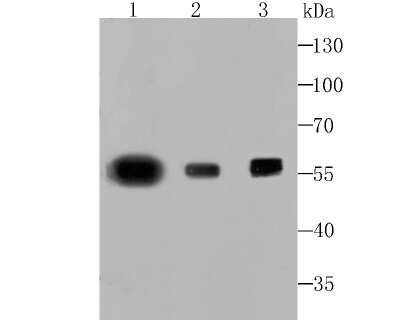 Western Blot: PTBP1 Antibody (JU41-20) [NBP2-75634] - Analysis of PTBP1 on different lysates using anti-PTBP1 antibody at 1/500 dilution.Positive control: Lane 1: K562  Lane 2: Jurkat Lane 3: Mouse colon tissue