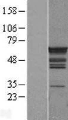 Western Blot PTBP1 Overexpression Lysate