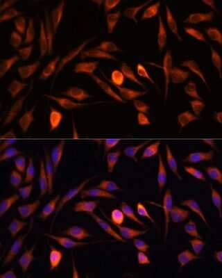 Immunocytochemistry/ Immunofluorescence PTCD1 Antibody - Azide and BSA Free