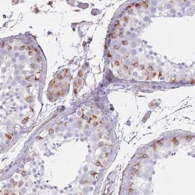 Immunohistochemistry-Paraffin PTCD1 Antibody - BSA Free
