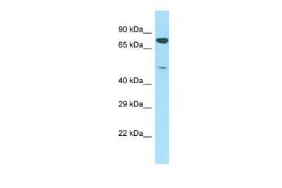 Western Blot: PTCD1 Antibody [NBP2-85557] - Host: Rabbit. Target Name: PTCD1. Sample Type: Jurkat Whole Cell lysates. Antibody Dilution: 1.0ug/ml