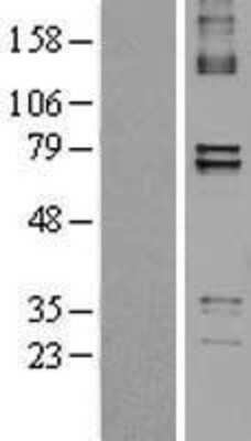 Western Blot: PTCD1 Overexpression Lysate (Adult Normal) [NBL1-14921] Left-Empty vector transfected control cell lysate (HEK293 cell lysate); Right -Over-expression Lysate for PTCD1.