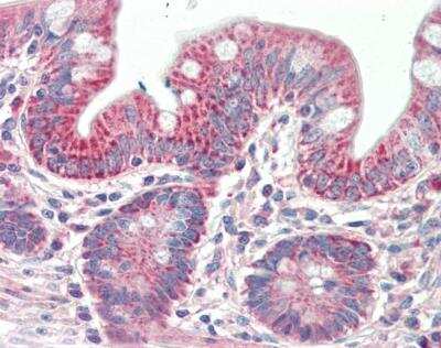 Immunohistochemistry-Paraffin PTCD2 Antibody