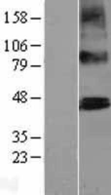 Western Blot: PTCD2 Overexpression Lysate (Adult Normal) [NBL1-14922] Left-Empty vector transfected control cell lysate (HEK293 cell lysate); Right -Over-expression Lysate for PTCD2.