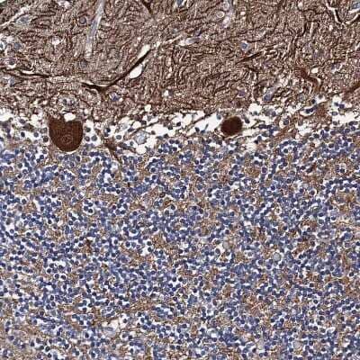 Immunohistochemistry-Paraffin PTCD3 Antibody