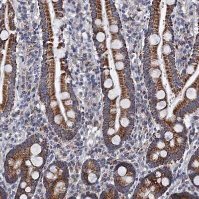 Immunohistochemistry-Paraffin PTCD3 Antibody