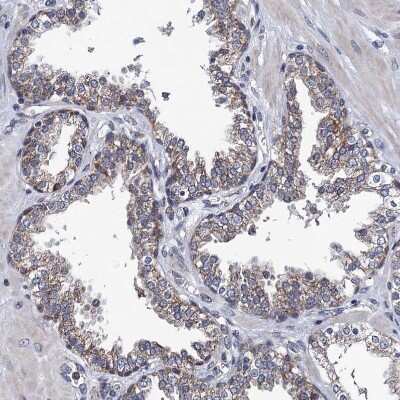 Immunohistochemistry-Paraffin: PTCD3 Antibody [NBP1-84125] - Staining of human prostate shows weak granular cytoplasmic positivity in glandular cells.