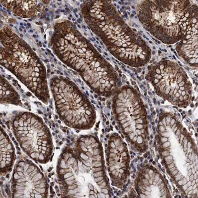 Immunohistochemistry-Paraffin: PTCD3 Antibody [NBP1-84126] - Staining of human stomach shows strong cytoplasmic positivity in glandular cells.