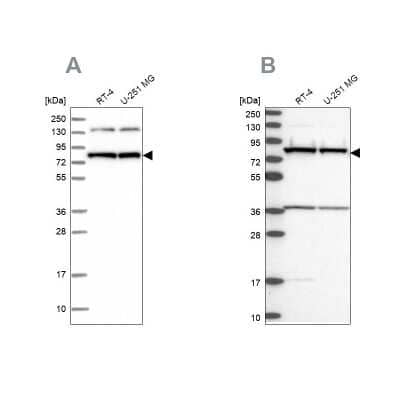 Western Blot PTCD3 Antibody