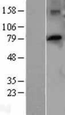 Western Blot: PTCD3 Overexpression Lysate (Adult Normal) [NBL1-14923] Left-Empty vector transfected control cell lysate (HEK293 cell lysate); Right -Over-expression Lysate for PTCD3.