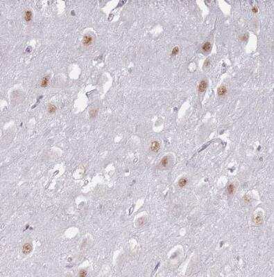 Immunohistochemistry-Paraffin: PTCHD1 Antibody [NBP2-13825] -  Staining of human hippocampus shows moderate nuclear positivity in neuronal cells.