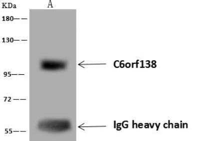 Immunoprecipitation: PTCHD4 Antibody [NBP3-12661] - Lane A:0.5 mg Jurkat Whole Cell Lysate4 uL anti-C6orf138 rabbit polyclonal antibody and 60 ug of Immunomagnetic beads Protein A/G.Primary antibody:Anti-C6orf138 rabbit polyclonal antibody,at 1:100 dilution Secondary antibody:Goat Anti-Rabbit IgG (H+L)/HRP at 1/10000 dilutionDeveloped using the ECL technique.Performed under reducing conditions.Predicted band size: 96 kDaObserved band size :96 kDa