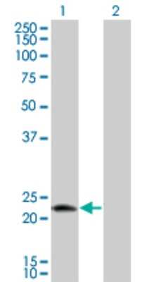 Western Blot: PTD016 Antibody (4H7) [H00051136-M01] - Analysis of LOC51136 expression in transfected 293T cell line by LOC51136 monoclonal antibody (M01), clone 4H7.Lane 1: LOC51136 transfected lysate(23.2 KDa).Lane 2: Non-transfected lysate.