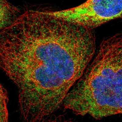 Immunocytochemistry/Immunofluorescence: PTDSS1 Antibody [NBP1-83060] - Staining of human cell line A-431 shows localization to endoplasmic reticulum. Antibody staining is shown in green.