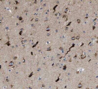 Immunohistochemistry-Paraffin PTDSS1 Antibody