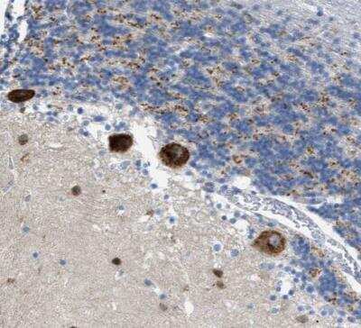 Immunohistochemistry-Paraffin PTDSS1 Antibody