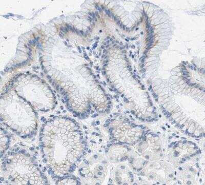 Immunohistochemistry-Paraffin PTDSS1 Antibody