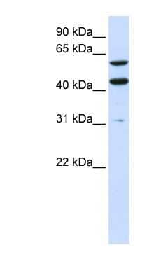 Western Blot: PTDSS1 Antibody [NBP1-59966] - 293T cells lysate, concentration 0.2-1 ug/ml.