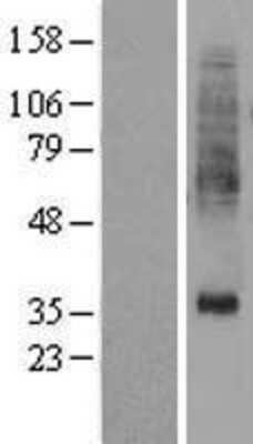 Western Blot: PTDSS1 Overexpression Lysate (Adult Normal) [NBL1-14925] Left-Empty vector transfected control cell lysate (HEK293 cell lysate); Right -Over-expression Lysate for PTDSS1.