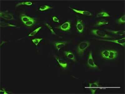 Immunocytochemistry/Immunofluorescence: PTEN Antibody (1C3) [H00005728-M13] - Analysis of monoclonal antibody to PTEN on HeLa cell. Antibody concentration 10 ug/ml