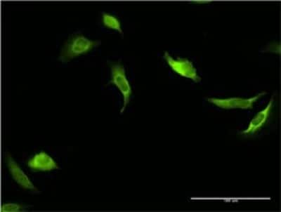 Immunocytochemistry/Immunofluorescence: PTEN Antibody (1E9) [H00005728-M06] - Analysis of monoclonal antibody to PTEN on HeLa cell. Antibody concentration 10 ug/ml