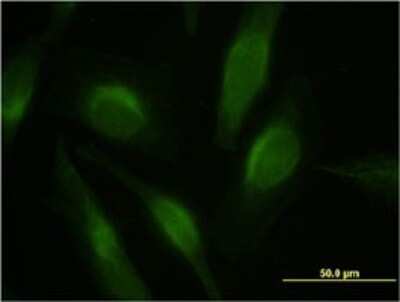 Immunocytochemistry/Immunofluorescence: PTEN Antibody (3E7) [H00005728-M02] - Analysis of monoclonal antibody to PTEN on HeLa cell . Antibody concentration 10 ug/ml.