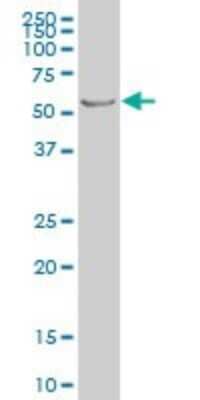Western Blot: PTEN Antibody (3E7) [H00005728-M02] - PTEN monoclonal antibody (M02), clone 3E7 Analysis of PTEN expression in C32.