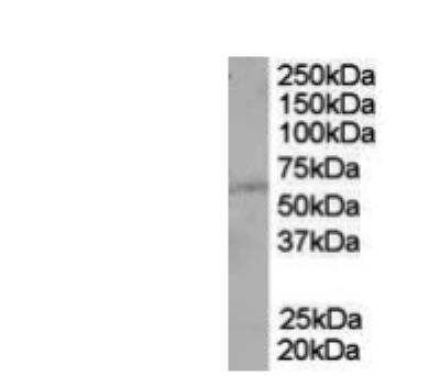 Western Blot: PTEN Antibody [NBP1-51919] -  staining of A431 lysate (35 ug protein in RIPA buffer). Primary incubation was 1 hour. Detected by chemiluminescence.