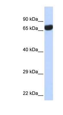 Western Blot: PTEN2/TPTE Antibody [NBP1-58240] - Human Lung lysate, concentration 0.2-1 ug/ml.