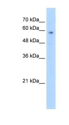 Western Blot: PTEN2/TPTE Antibody [NBP1-58242] - Jurkat cell lysate, concentration 2.5 ug/ml.