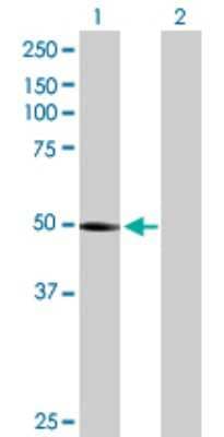 Western Blot: PTENP1 Antibody [H00011191-B01P] - Analysis of PTENP1 expression in transfected 293T cell line by PTENP1 polyclonal antibody.  Lane 1: PTENP1 transfected lysate(40.59 KDa). Lane 2: Non-transfected lysate.