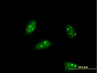 Immunocytochemistry/Immunofluorescence: PTF1A Antibody (1A2) [H00256297-M05] - Analysis of monoclonal antibody to PTF1A on HeLa cell. Antibody concentration 10 ug/ml