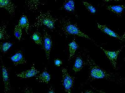 Immunocytochemistry/Immunofluorescence: PTF1A Antibody [NBP2-98726] - Immunofluorescence staining of PTF1A in HeLa cells. Cells were fixed with 4% PFA, permeabilzed with 0.3% Triton X-100 in PBS, blocked with 10% serum, and incubated with rabbit anti-human PTF1A polyclonal antibody (1:5000) at 4C overnight. Then cells were stained with the Alexa Fluor(R)488-conjugated Goat Anti-rabbit IgG secondary antibody (green) and counterstained with DAPI (blue). Positive staining was localized to cytoplasm and nucleus.