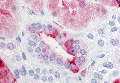 Immunohistochemistry-Paraffin: PTGER2 Antibody [NBP1-02379] - Staining of human kidney. Immunohistochemistry of formalin-fixed, paraffin-embedded tissue after heat-induced antigen retrieval. Antibody concentration 20 ug/ml.