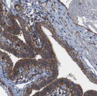 Immunohistochemistry-Paraffin: PTGER4/EP4 Antibody [NBP1-84833] - Staining of human fallopian tube shows moderate to strong membranous positivity in non - germinal center cells.