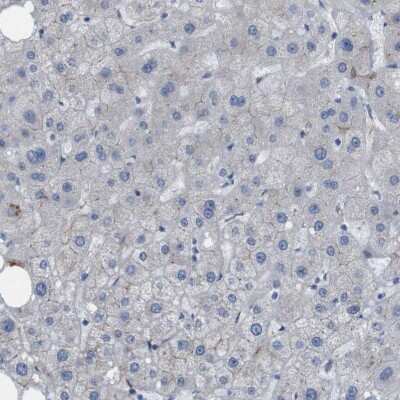 Immunohistochemistry-Paraffin: PTGER4/EP4 Antibody [NBP1-84833] - Staining of human liver shows very weak membranous positivity in hepatocytes.