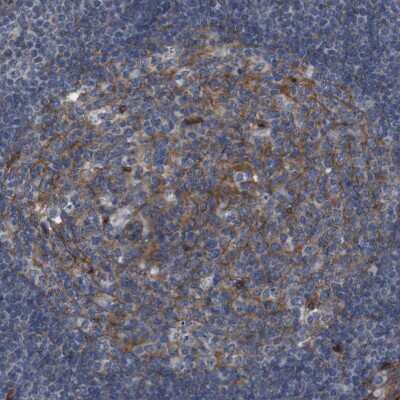 Immunohistochemistry-Paraffin: PTGER4/EP4 Antibody [NBP1-84833] - Staining of human lymph node shows moderate membranous positivity in germinal center cells.