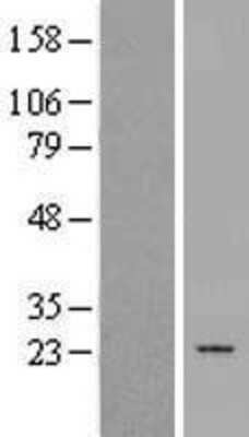 Western Blot: PTGES2 Overexpression Lysate (Adult Normal) [NBP2-04640] Left-Empty vector transfected control cell lysate (HEK293 cell lysate); Right -Over-expression Lysate for PTGES2.
