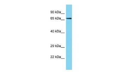 Western Blot: PTGES3L-AARSD1 Antibody [NBP2-83430] - Host: Rabbit. Target Name: PTGES3L-AARSD1. Sample Type: Jurkat Whole Cell lysates. Antibody Dilution: 1.0ug/ml