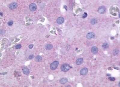 Immunohistochemistry-Paraffin: PTGFR Antibody [NLS1048] - Analysis of anti-FP / PTGFR antibody with ovary.