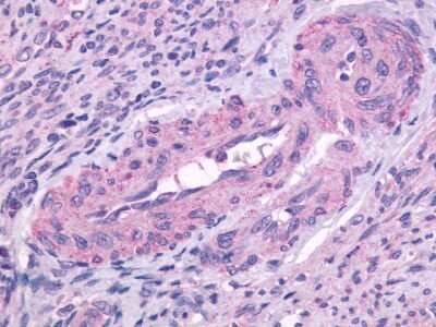 Immunohistochemistry-Paraffin: PTGFR Antibody [NLS1049] - Analysis of anti-FP / PTGFR antibody with human ovary.