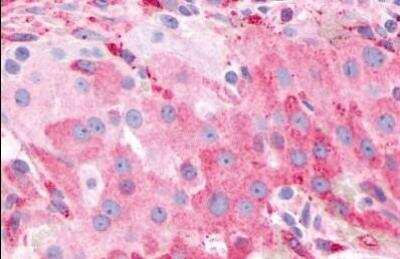 Immunohistochemistry-Paraffin: PTGFR Antibody [NLS6624] - Analysis of anti-PTGFR antibody with human ovary.