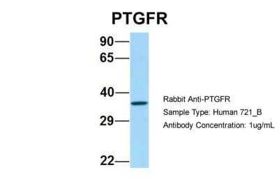 Western Blot: PTGFR Antibody [NBP2-82318] - Host: Rabbit. Target Name: PTGFR. Sample Type: Human 721_B. Antibody Dilution: 1.0ug/mlPTGFR is supported by BioGPS gene expression data to be expressed in 721_B