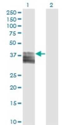 Western Blot: PTGIR Antibody (2A7) [H00005739-M02] - Analysis of PTGIR expression in transfected 293T cell line by PTGIR monoclonal antibody (M02), clone 2A7.Lane 1: PTGIR transfected lysate(41 KDa).Lane 2: Non-transfected lysate.