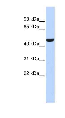 Western Blot: PTGIS Antibody [NBP1-62390] - Human Brain lysate, concentration 0.2-1 ug/ml.