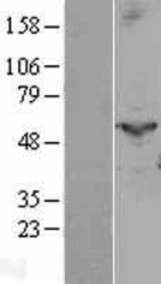 Western Blot: PTGIS Overexpression Lysate (Adult Normal) [NBL1-14940] Left-Empty vector transfected control cell lysate (HEK293 cell lysate); Right -Over-expression Lysate for PTGIS.