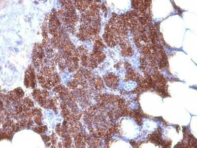 Immunohistochemistry-Paraffin: PTH Antibody (3H9 + PTH/1175) - Azide and BSA Free [NBP2-47731] - Human Parathyroid stained with PTH Monoclonal Antibody (3H9 + PTH/1175).