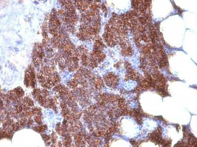 Immunohistochemistry-Paraffin: PTH Antibody (3H9 + PTH/1175) - IHC-Prediluted [NBP2-48404] - Parathyroid stained with PTH Monoclonal Antibody (3H9 + PTH/1175).