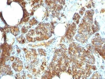 Immunohistochemistry-Paraffin: PTH Antibody (PTH/1173) - Azide and BSA Free [NBP2-47728] - Human Parathyroid stained with PTH Monoclonal Antibody (PTH/1173).